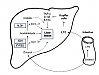 Polymorphisms in interleukin-1 gene cluster are associated with increased risk of alcoholic liver cirrhosis