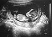 Ultrasonography - diagnostics in medicine